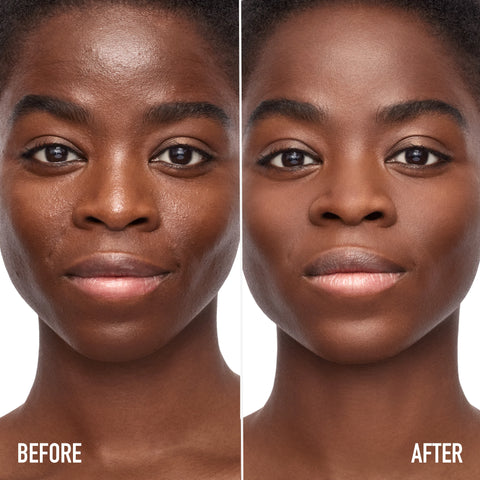 Set and Protect Bundle